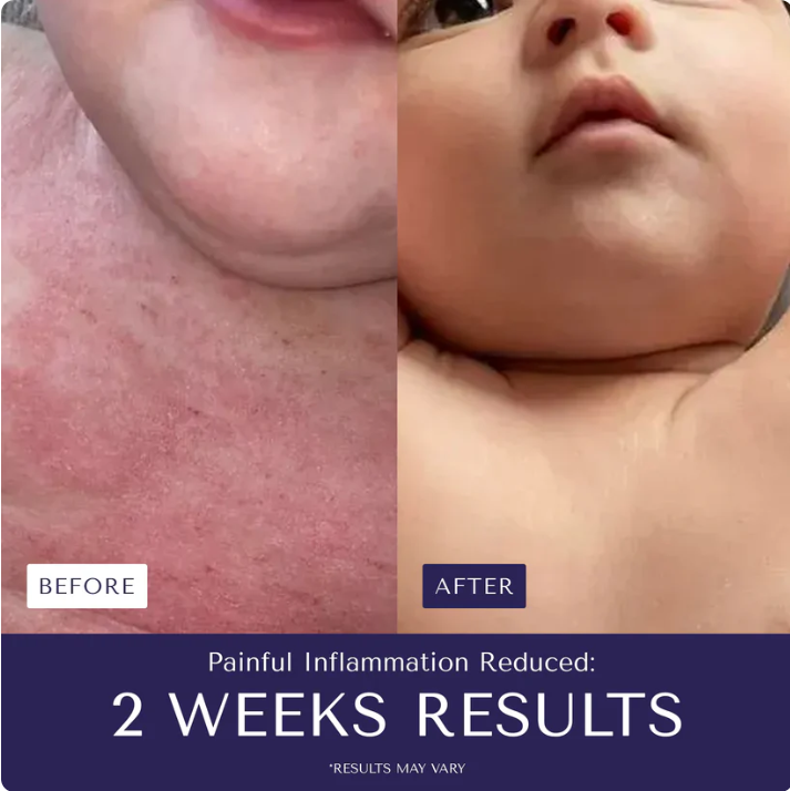 Nurture Natural Soothing Cream with Sea Moss & Oats | Eczema & Psoriasis Relief