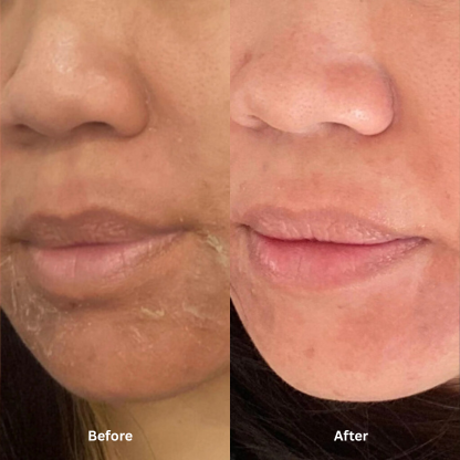 Nurture | Illiyoon Ceramide Ato Concentrate Cream