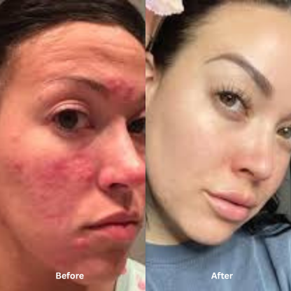 Nurture | Illiyoon Ceramide Ato Concentrate Cream