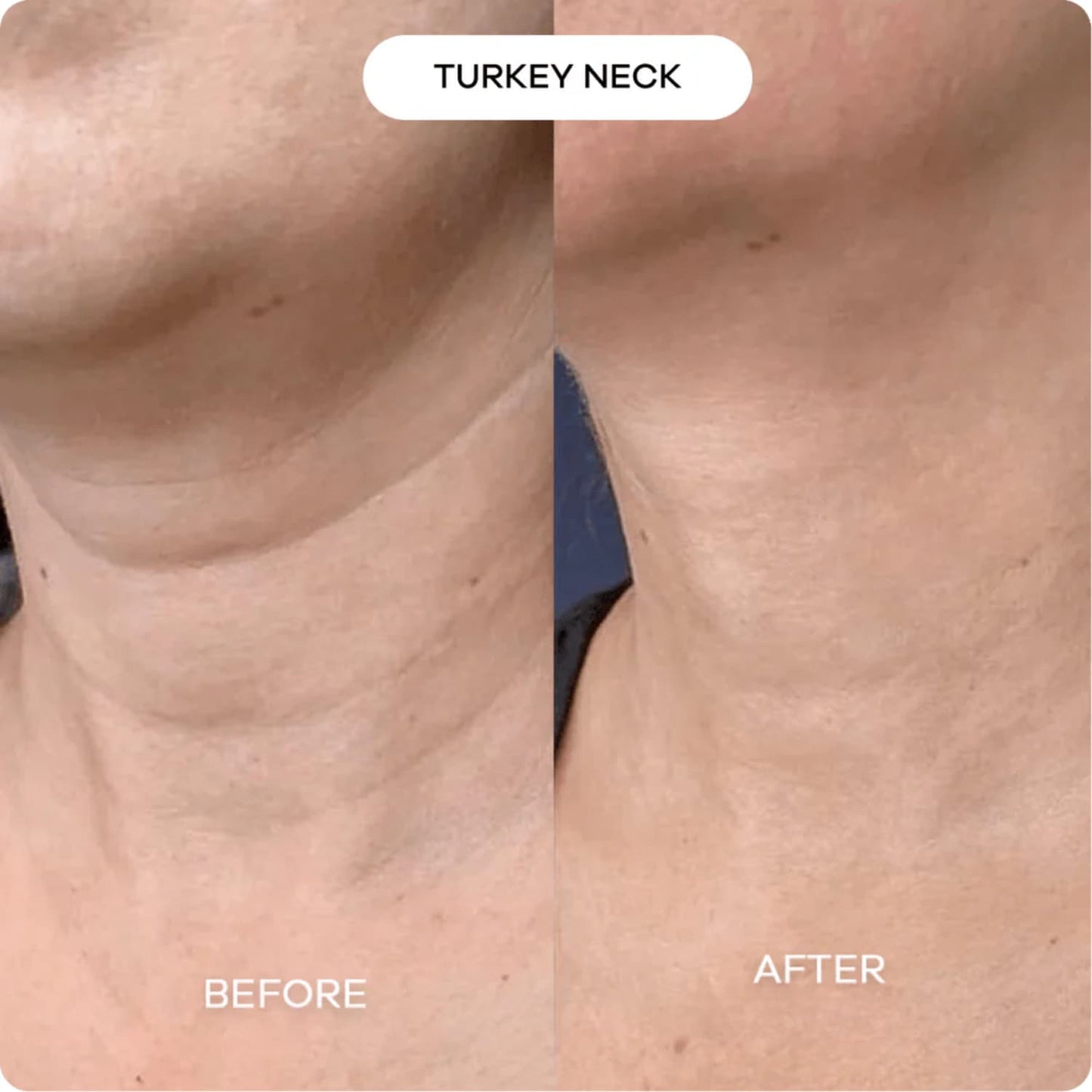 Nurture BIOHEAL 3D Lifting Cream