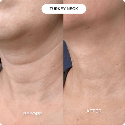 Nurture BIOHEAL 3D Lifting Cream