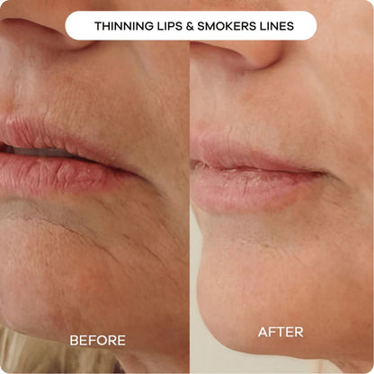 Nurture BIOHEAL 3D Lifting Cream