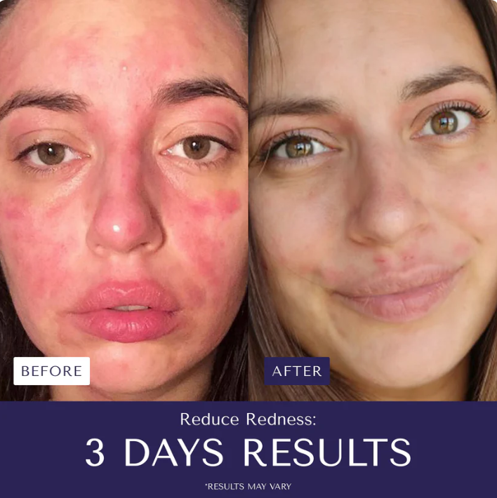 Nurture Natural Soothing Cream with Sea Moss & Oats | Eczema & Psoriasis Relief