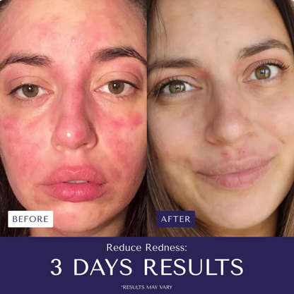 Nurture Natural Soothing Cream with Sea Moss & Oats | Eczema & Psoriasis Relief