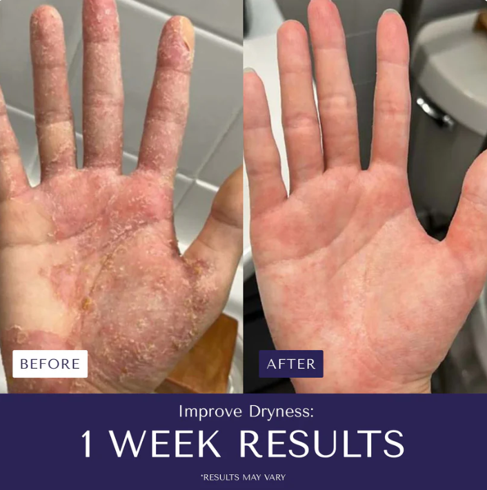 Nurture Natural Soothing Cream with Sea Moss & Oats | Eczema & Psoriasis Relief