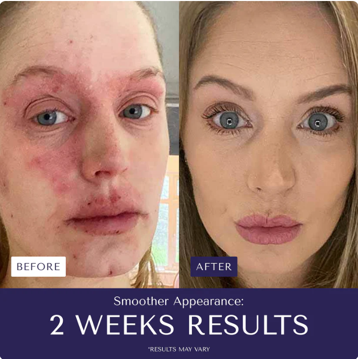 Nurture Natural Soothing Cream with Sea Moss & Oats | Eczema & Psoriasis Relief