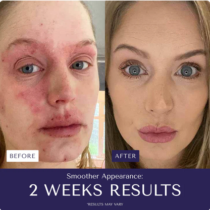 Nurture Natural Soothing Cream with Sea Moss & Oats | Eczema & Psoriasis Relief