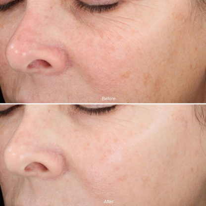 Nurture | Illiyoon Ceramide Ato Concentrate Cream