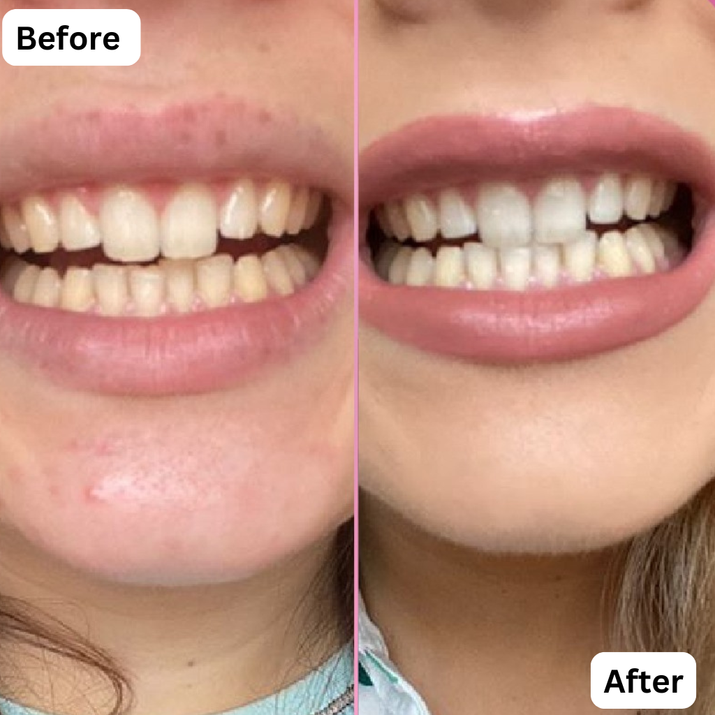 7-Pro Intensive Toothpaste | Deep Enamel Repair & Long-Lasting Freshness