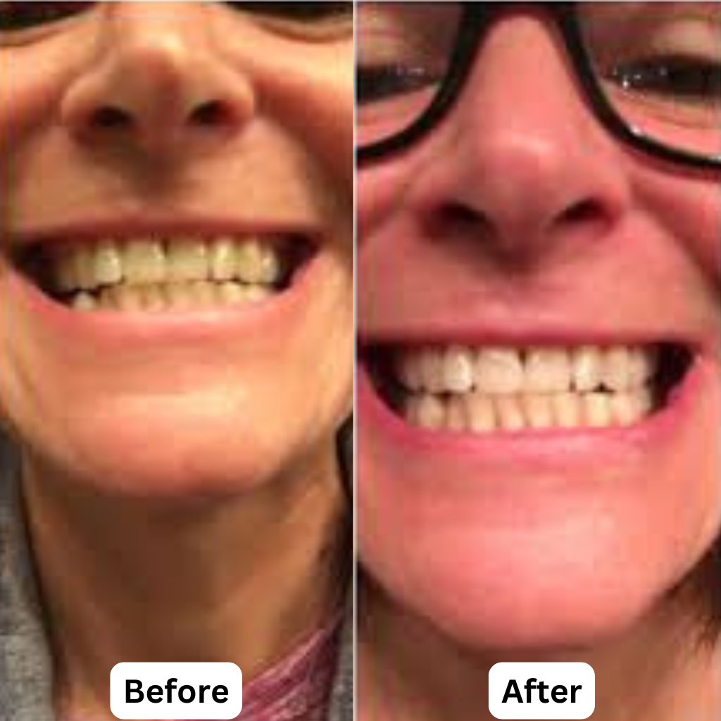 7-Pro Intensive Toothpaste | Deep Enamel Repair & Long-Lasting Freshness