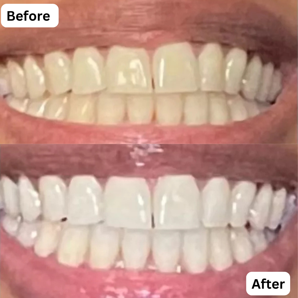 7-Pro Intensive Toothpaste | Deep Enamel Repair & Long-Lasting Freshness